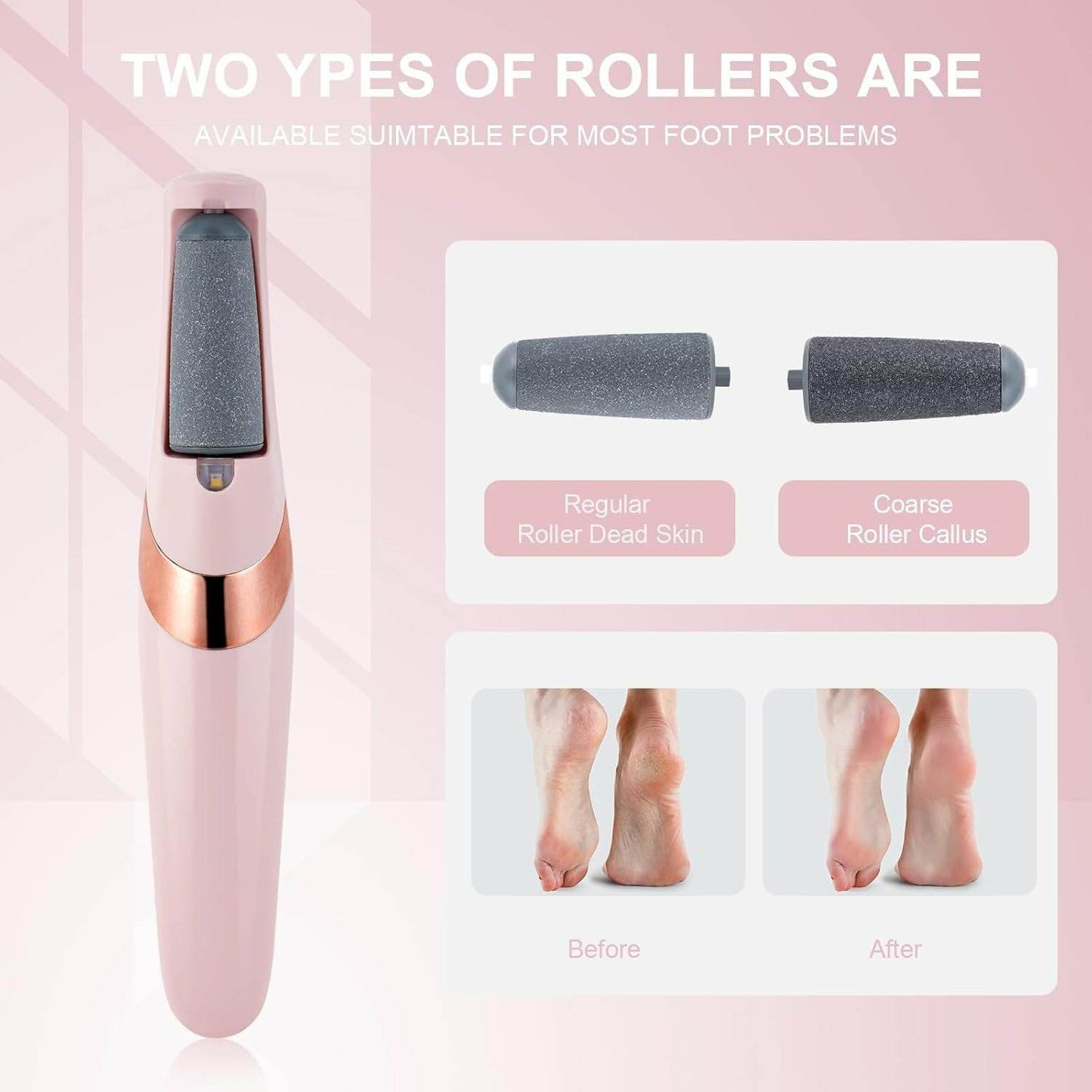 Electric Pedicure Foot File And Callus Remover