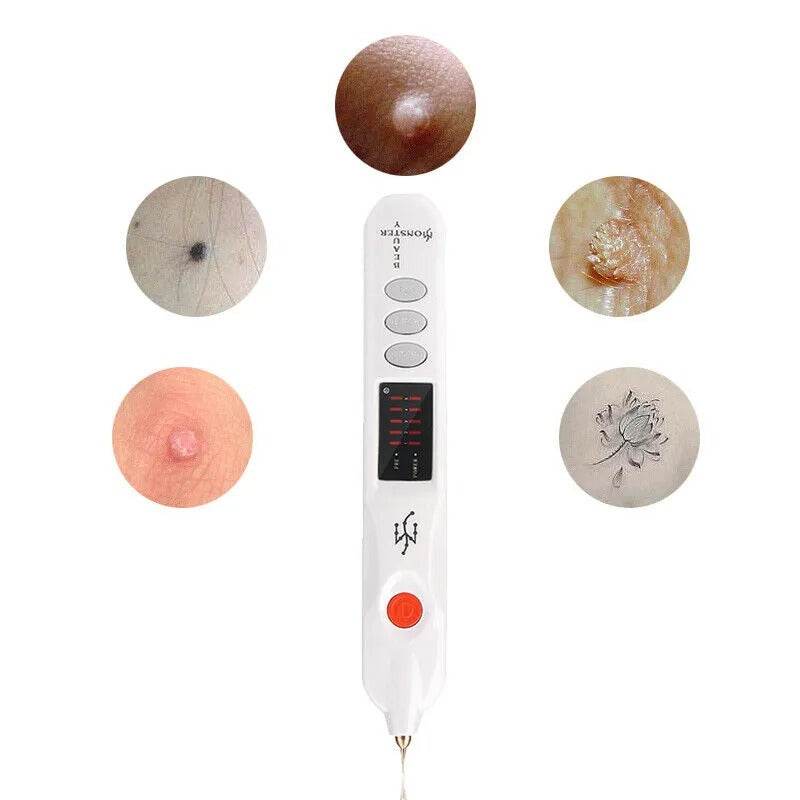 Fibroblast Plasma Pen (Mole Remover)