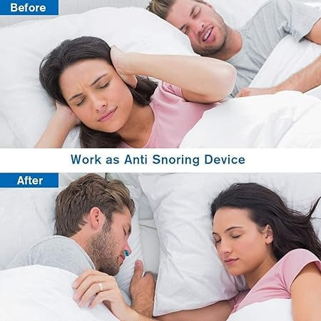 Anti Snoring Device