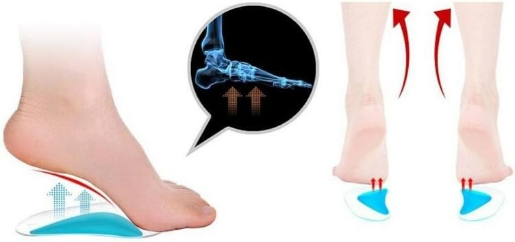 Arch Support Insoles Flat Feet For Infants