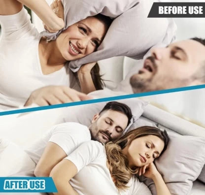 Anti-Snore Mouthpiece